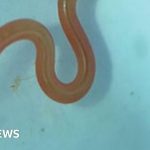 Live worm found in Australian woman’s brain in world first