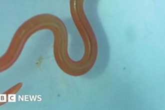 Live worm found in Australian woman’s brain in world first