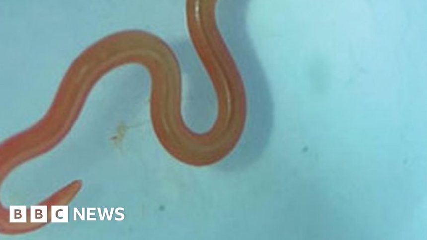 Live worm found in Australian woman’s brain in world first