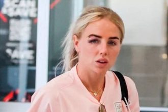 True extent of Alex Greenwood’s head injury comes to light as she is pictured with black eye and a stitched-up cut after England’s heartbreak