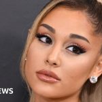 Ariana Grande says she used lip filler and Botox to 'hide'