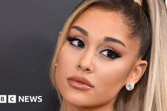 Ariana Grande says she used lip filler and Botox to 'hide'