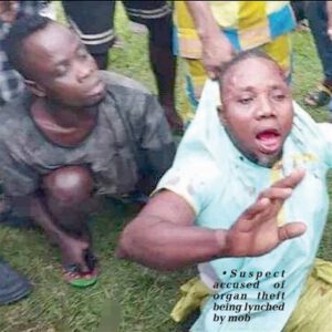 Calabar Residents Cry Out Over Rise In Genitals’ Disappearance After Handshakes, Hugs » Naijaloaded