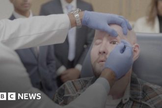 Arkansas man receives world’s first eye transplant